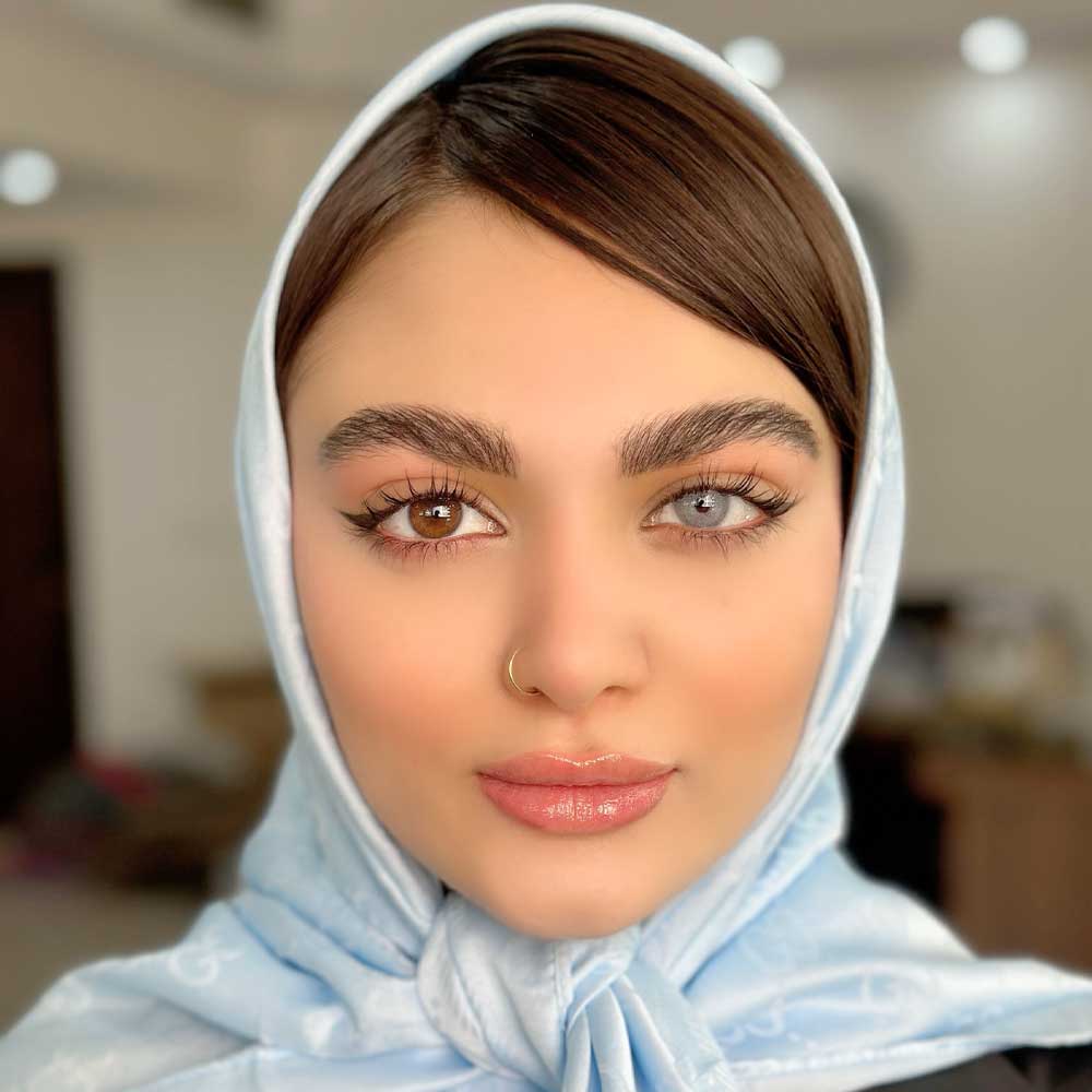 لنز طبی رنگی برند یونیک رنگ كارنلين